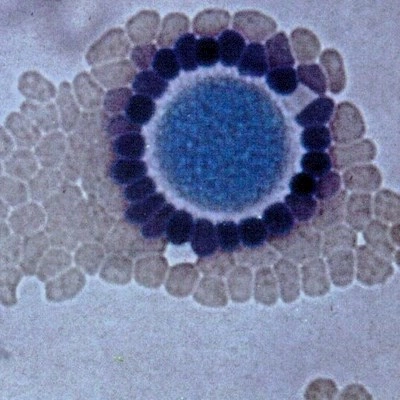 Forskningscenter for Seksuelt Overf&oslash;rte Infektioner forsker i bedre forebyggelse, diagnostik og fremtidens behandling af seksuelt overf&oslash;rte infektioner.